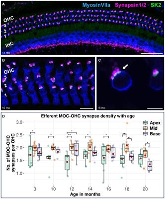 Age-related alterations in efferent medial olivocochlear-outer hair cell and primary auditory ribbon synapses in CBA/J mice